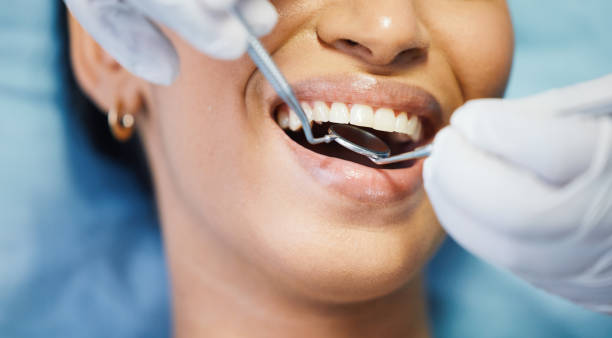 Best Emergency Dentist for Knocked-Out Tooth in Gate City, VA